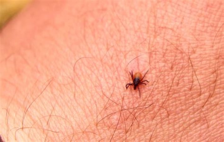 Can Chiggers Burrow Beneath Your Skin?
