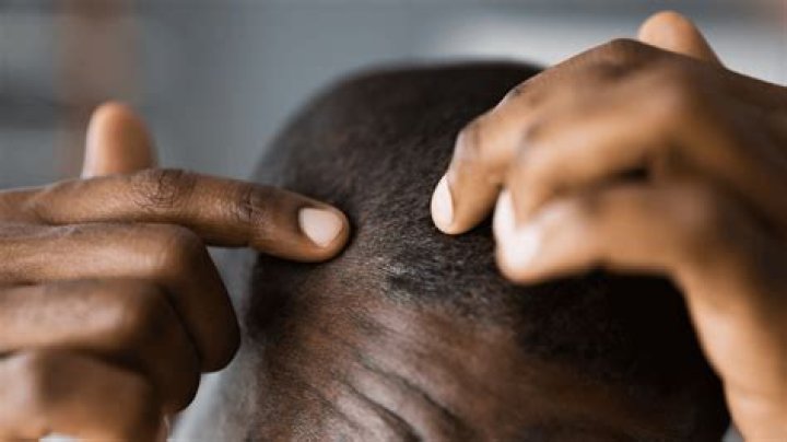 Discover The Secrets To Unlocking Optimal Hair Growth For Black Men