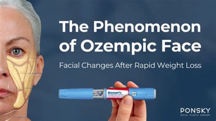 Discover Unstoppable Ways To Conquer Nausea From Ozempic!
