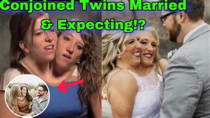 Discoveries In "2 Headed Twins Married"