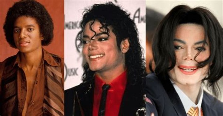 Michael Jackson's Skin: Vitiligo & Transformation Explained