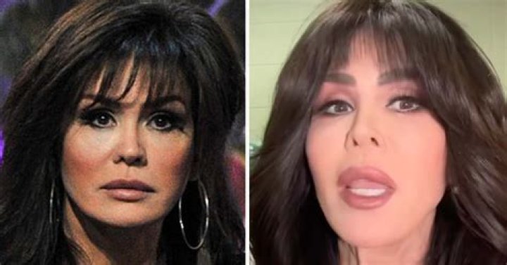 Uncovering The Truth Behind Marie Osmond's 2023 Plastic Surgery Journey