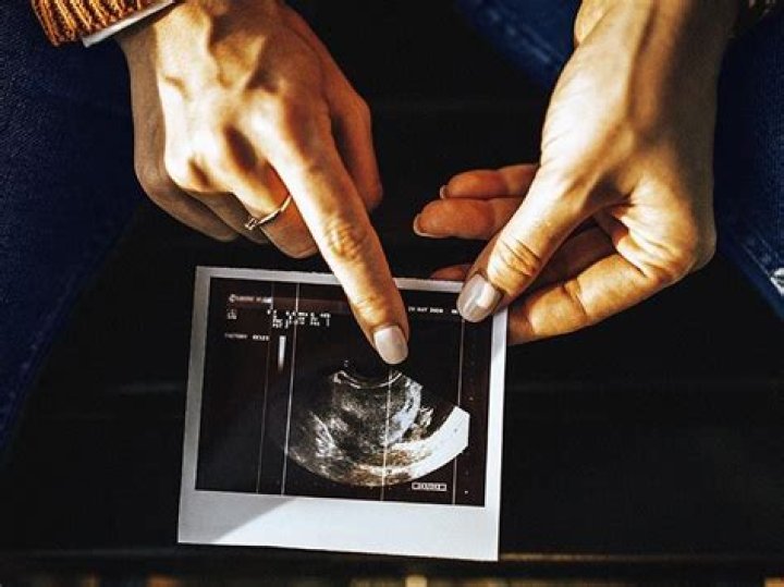 What Habits Can Cause a Miscarriage? Understanding Lifestyle Choices and Pregnancy Health